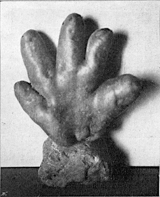 Eine in Mistelbach gefundene "Kartoffelabnormität" über die sogar in der Zeitung berichtet wurde.