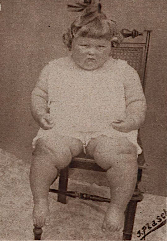 Barbara "Wetti" Nissler im Jahr 1926: 2 Jahre und 6 Monate alt, 90 cm, 38 kg